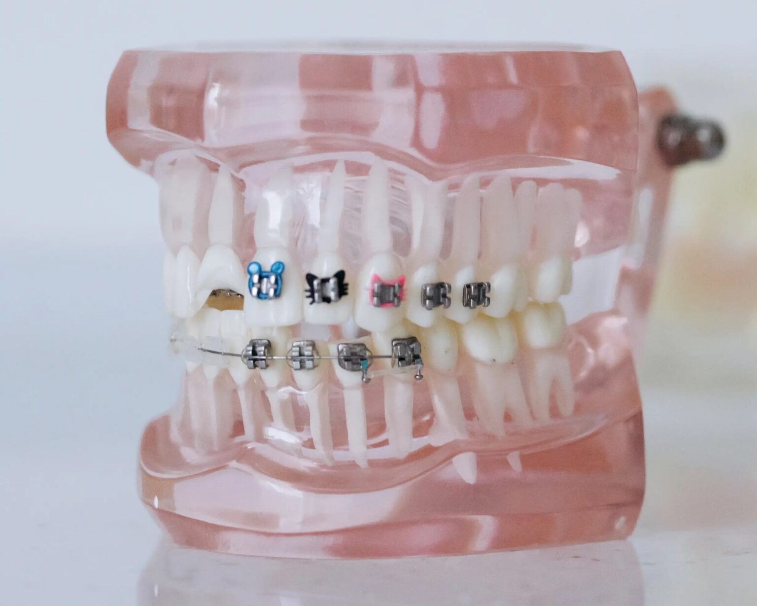 Aparat ortodontyczny