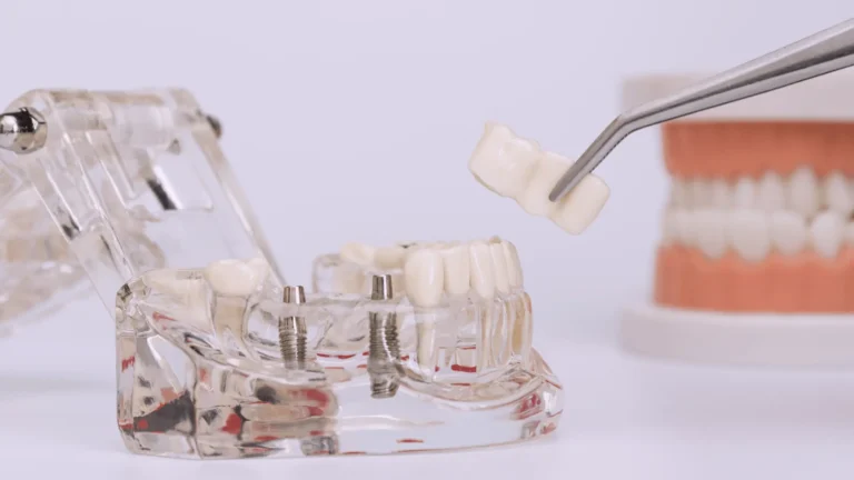 korona na implancie cena